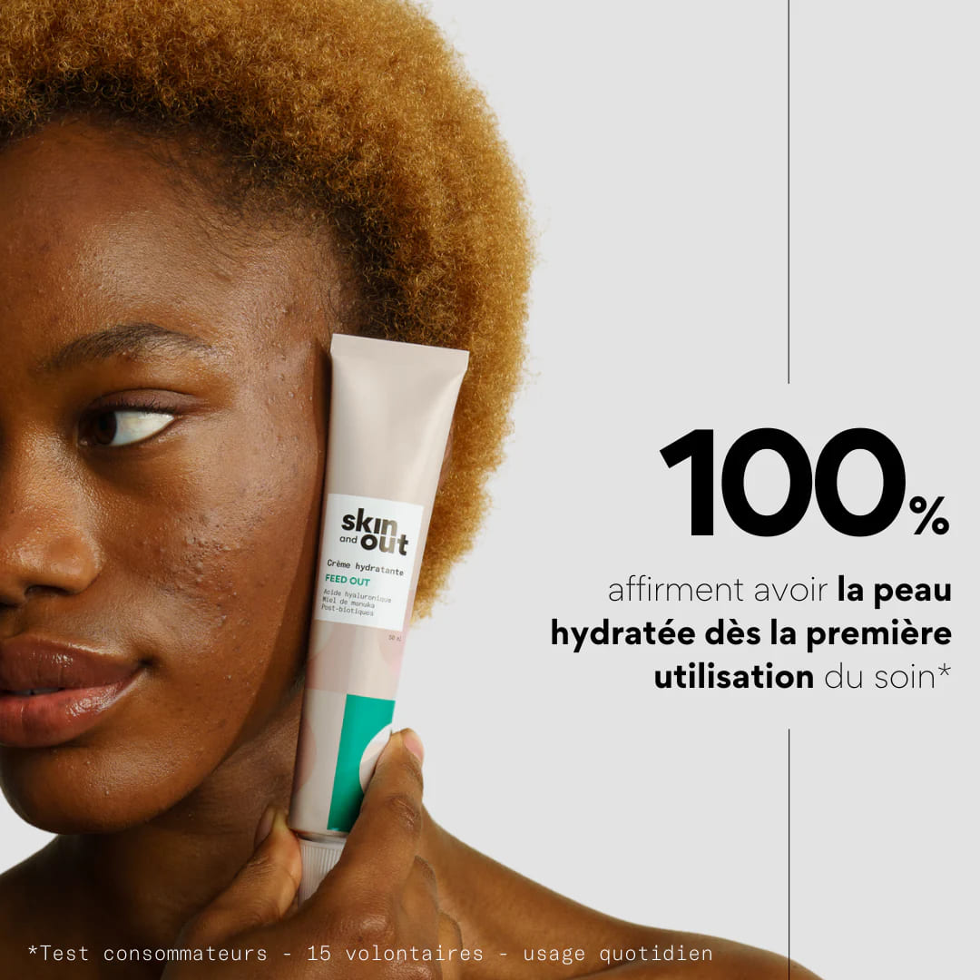 CRÈME HYDRATANTE SPÉCIALE BOUTONS